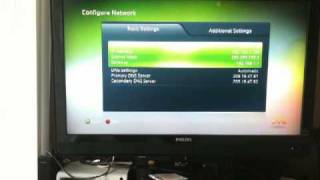 How to Manually Configure Your Xbox Network Settings to get a Static IP Address [upl. by Stanford482]