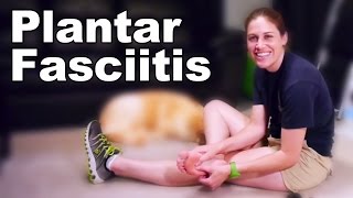 Top 10 Ways To Cure Plantar Fasciitis [upl. by Assirod]