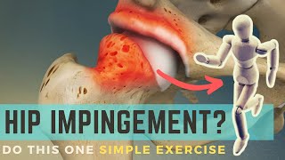 Banded Hip Mobilizations  Techniques for Hip Impingement [upl. by Kappenne194]