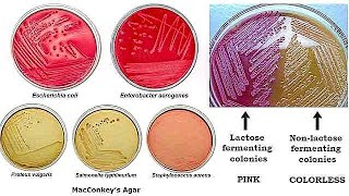 MacConkey Agar [upl. by Wheelwright]