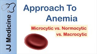 Anemia  Microcytic vs Normocytic vs Macrocytic [upl. by Anahc736]