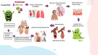 Bronquiolitis parte 1FisiopatologíaPediatría [upl. by Deegan]