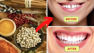 How to fix gap between teeth naturally at home without braces [upl. by Eisse]