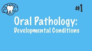 Oral Pathology  Developmental Conditions  INBDE ADAT [upl. by Ingra985]