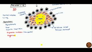 Tuberculosis for USMLE Step 1 and USMLE Step 2 [upl. by Og53]