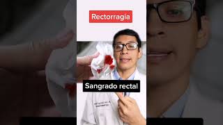 Causas benignas de sangrado rectal [upl. by Nert]