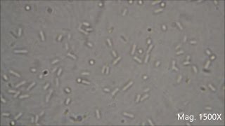 Bacterial Colony Morphology with Live Examples [upl. by Wearing]