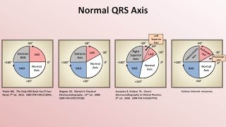 Intro to EKG Interpretation  Rate and Axis [upl. by Nylacaj443]