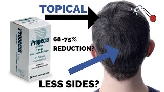 Topical Finasteride Science Pros and Cons and Practical Tips [upl. by Assilim]