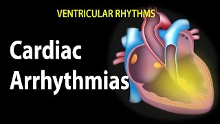 Cardiac Arrhythmias Animation [upl. by Langston998]