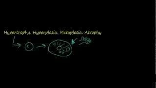 2  Introduction to pathology  hypertrophy hyperplasia [upl. by Anelrad600]