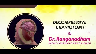 Decompressive craniotomy  DrRanganadham Senior consultant Neurosurgeon [upl. by Coad]