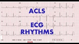 ACLS  ECG rhythm recognition amp management Part 1 [upl. by Dagley]