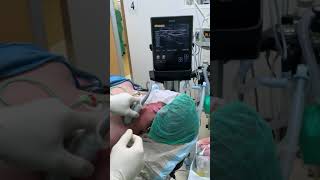 Ultrasound Guided Intercostobrachial Nerve Block [upl. by Yhprum]