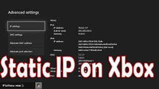 How to Setup Static IP on Xbox One [upl. by Dloreh485]