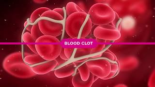 Coagulation Cascade Explained [upl. by Berk109]