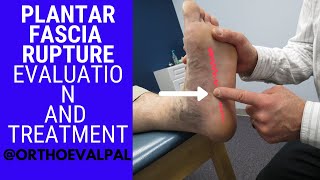 Plantar Fascia Rupture Evaluation with Paul Marquis PT [upl. by Nevin]