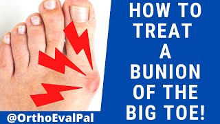 How to Treat a Bunion of the Big Toe [upl. by Caines]