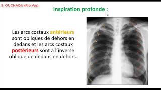 Comment interpréter une radiographie thoracique de face  Partie 1 [upl. by Iem]