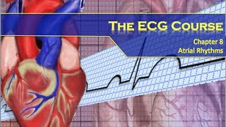 The ECG Course  Atrial Rhythms [upl. by Dixie243]