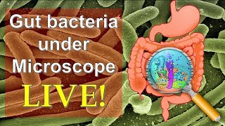 E Coli Bacteria Microbiology  Escherichia Coli  E Coli Disease [upl. by Estren294]