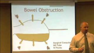 Bowel Obstruction Gas Pattern and Presentations [upl. by Wilonah]