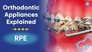 Orthodontic Appliances Explained  RPE [upl. by Ringler419]