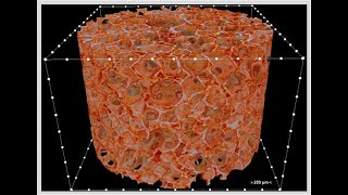 Lyophilization Freeze drying pharmaceuticals [upl. by Finlay]