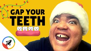 How To Give Yourself a Gap Tooth  5 Pressuring Ways [upl. by Maggio]