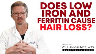 Why Are Ferritin Levels Important for Healthy Hair [upl. by Deryl192]