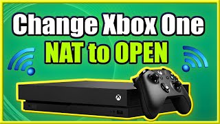 How to Change Xbox One NAT to OPEN and FIX Strict Connection Issues Easy Method [upl. by Gerhardt361]