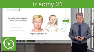 Trisomy 21 Down Syndrome Introduction – Pediatrics  Lecturio [upl. by Acirej]