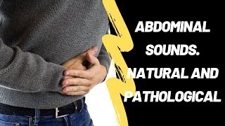 Abdominal Sounds Natural And Pathological [upl. by Erdnassac]