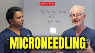 Dermarolling Microneedling and Hair Loss [upl. by Dore]