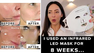 I used the CurrentBody LED Mask for 8 weeks amp this happened [upl. by Camilo250]