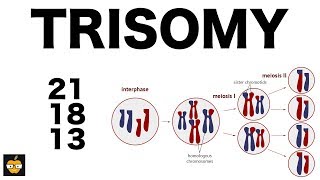 Trisomy 21 18 and 13 amp Nondisjunction Genetics [upl. by Ekenna]