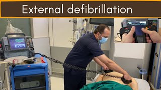 External defibrillation DC Shock [upl. by Key]