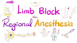 Supraclavicular Brachial Plexus Block [upl. by Wooldridge]