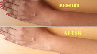 How To Remove Sun Tan From Your Body Instantly  Home remedy [upl. by Eizzo936]