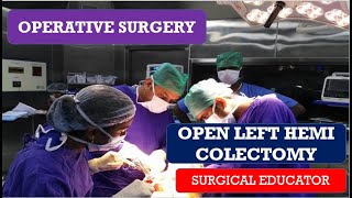 OPEN LEFT HEMICOLECTOMY STEP BY STEP Operative Surgery [upl. by Ogram]