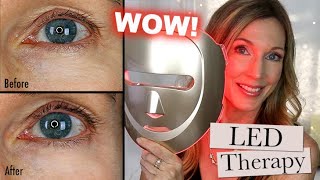 LED Red Light AntiAging Mask for Wrinkles Does It Work [upl. by Yodlem92]