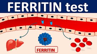 Serum Ferritin test  Its role in inflammation [upl. by Thomasa233]