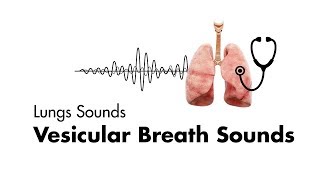 Vesicular Breath Sounds  Normal Lung Sounds  MEDZCOOL [upl. by Gurevich]