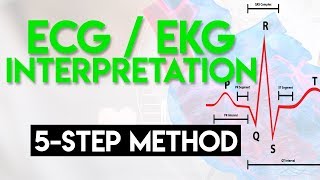 ECG Interpretation Made Easy  ECG EKG Interpretation Part 2 [upl. by Annasus]