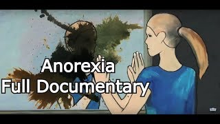 Anorexia  Modern Eating Disorder Treatment Documentary  Full HD [upl. by Barstow64]