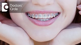 How to close the gap between upper amp lower front teeth  Dr Aniruddha KB [upl. by Eidnalem]