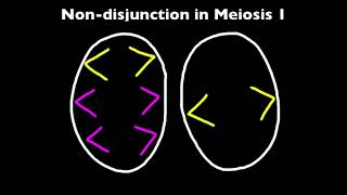 33 Nondisjunction and Down Syndrome [upl. by Assyle]