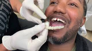 Houston Cosmetic Dentist How to close those gaps without braces affordably [upl. by Burr]