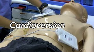 Cardioversion  Defibrillation Technique [upl. by Eiveneg]