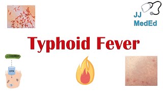 Typhoid Fever Pathogenesis vectors bacteria Symptoms Diagnosis Treatment Vaccine [upl. by Aitenev149]